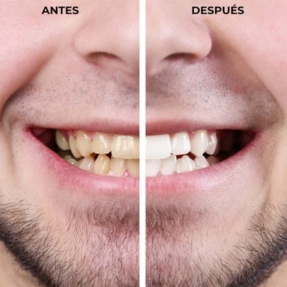 Lápiz Blanqueador de Dientes - Dientes blancos en minutos