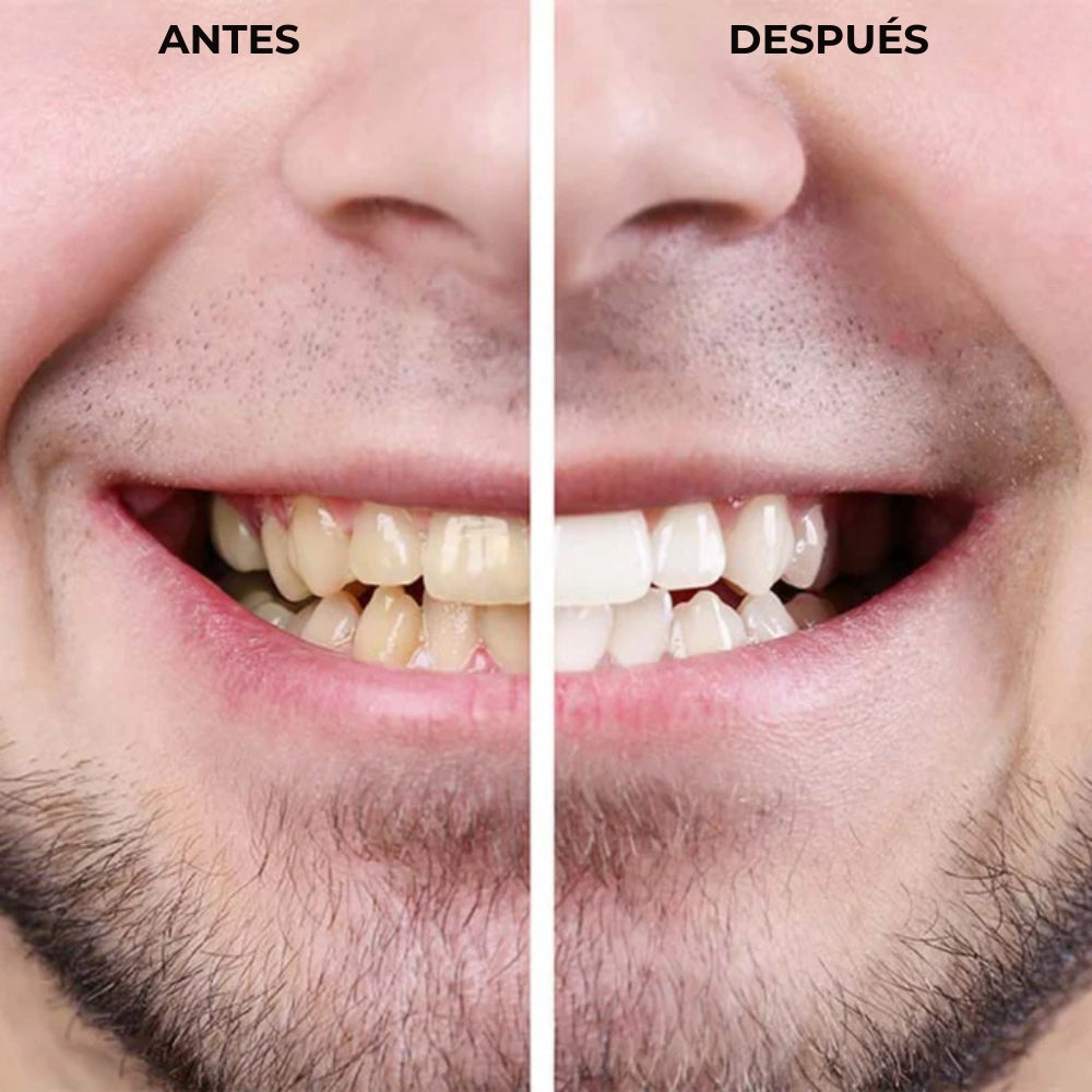 Lápiz Blanqueador de Dientes - Dientes blancos en minutos