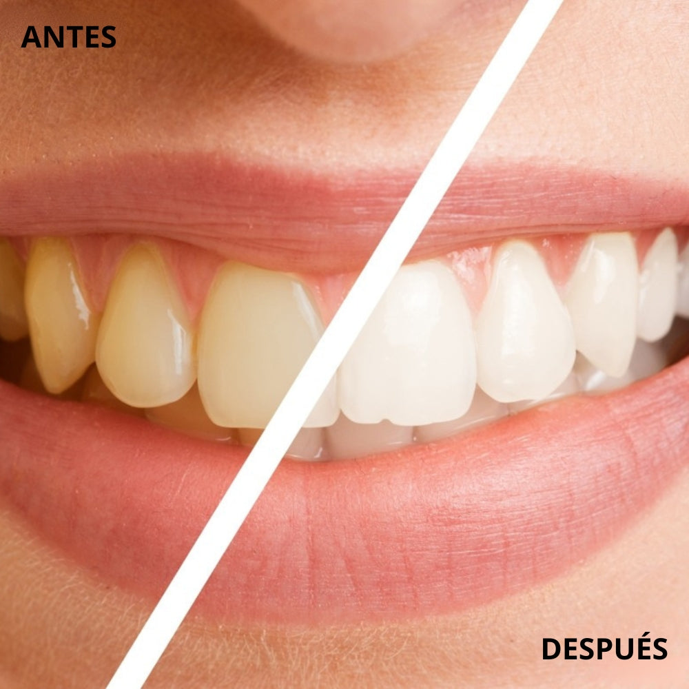 Lápiz Blanqueador de Dientes - Dientes blancos en minutos