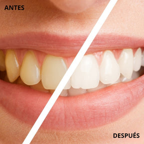 Lápiz Blanqueador de Dientes - Dientes blancos en minutos