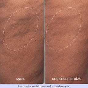 Crema Reafirmante para Glúteos y Muslos - Transforma el Aspecto